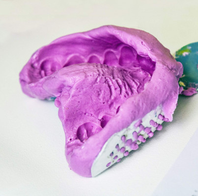Dentdays Glossar Alginat